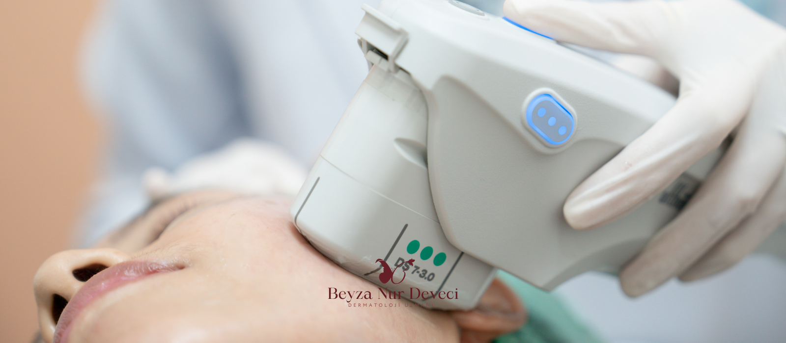 Ultherapy Prime (Ulthera)