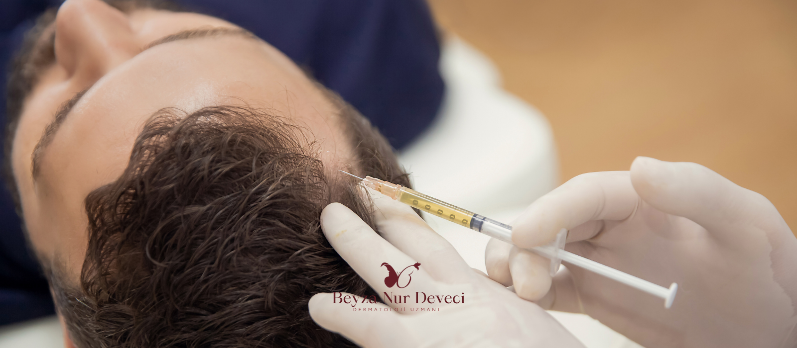 Mezoterapi Uygulaması PRP